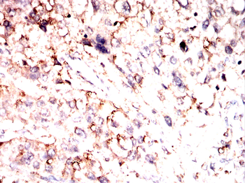 TF Antibody