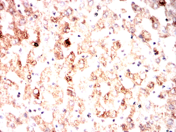 TF Antibody
