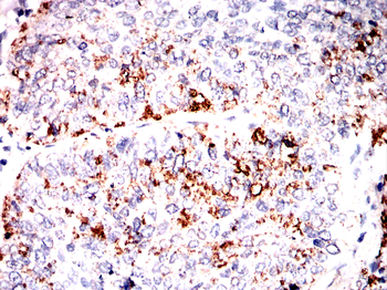 TF Antibody