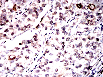 S100A8/S100A9 Antibody