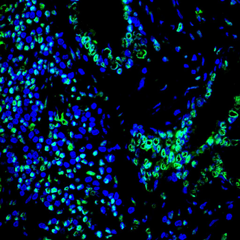 S100A8/S100A9 Antibody