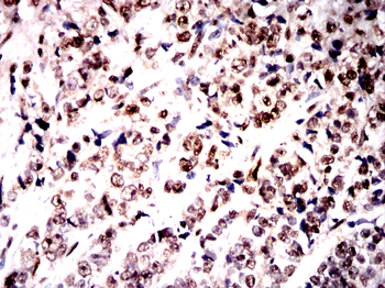 S100A8/S100A9 Antibody