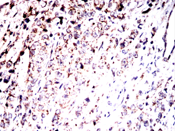 FH Antibody