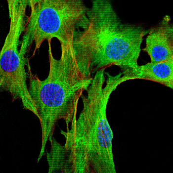 Luciferase antibody