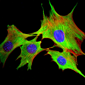 ENO2 Antibody