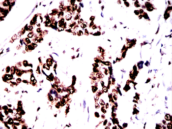 MAPT Antibody