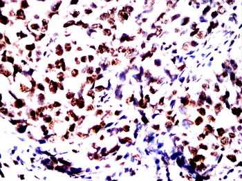 MAPT Antibody