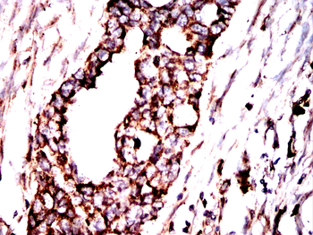 HSPA5 Antibody