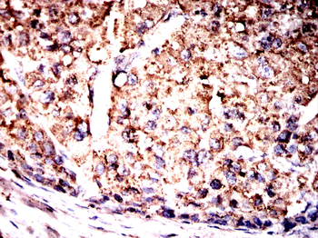 HSPA5 Antibody