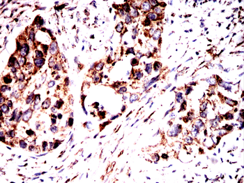 HSPA5 Antibody
