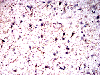 GFAP Antibody