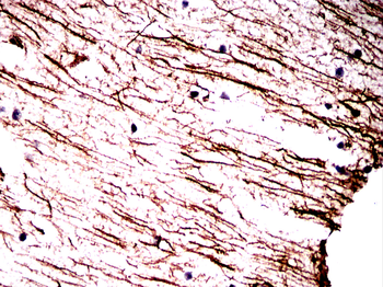 GFAP Antibody