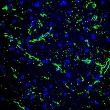 GFAP Antibody