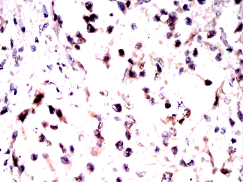 Oct-1 antibody