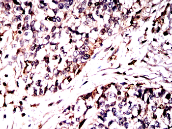 LGALS3 Antibody