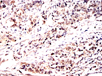 LGALS3 Antibody