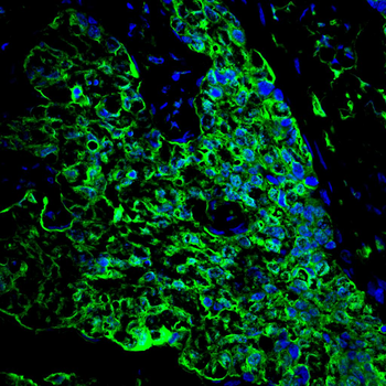 LGALS3 Antibody