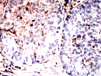 LGALS3 Antibody