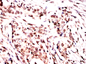 TBP Antibody