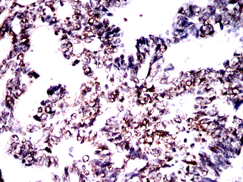 TBP Antibody