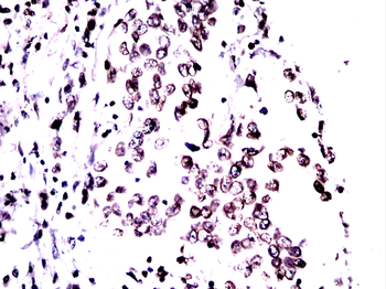 LMNB1 Antibody