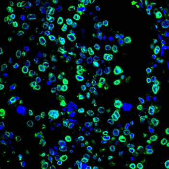 LMNB1 Antibody