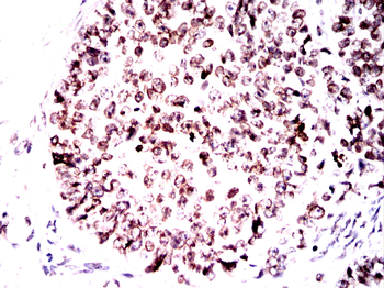 LMNB1 Antibody