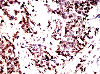 LMNB1 Antibody