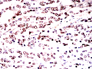 LMNB1 Antibody
