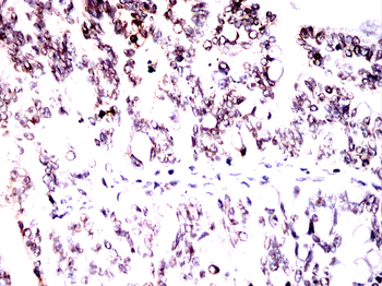 LMNB1 Antibody