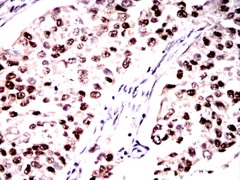 DNAJB1 Antibody