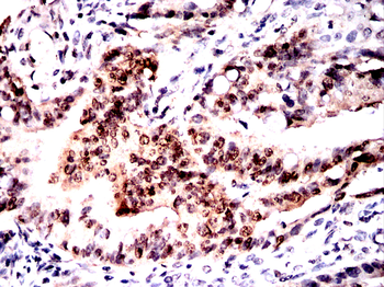 DNAJB1 Antibody