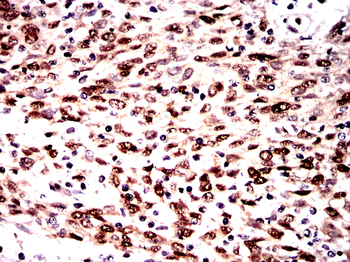 DNAJB1 Antibody
