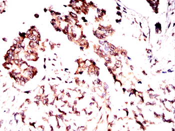 CTNNB1 Antibody