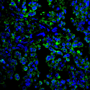 CTNNB1 Antibody