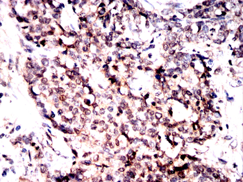 CTNNB1 Antibody