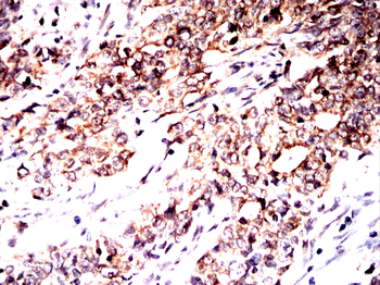 MAP2K2 Antibody