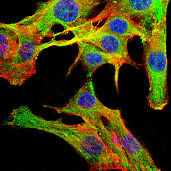 SERPINB5 Antibody