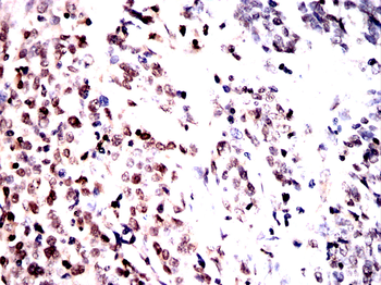 CBX5 Antibody