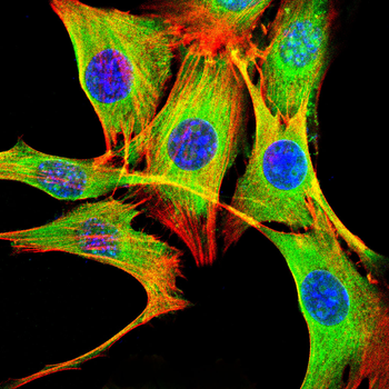 SMAD7 Antibody