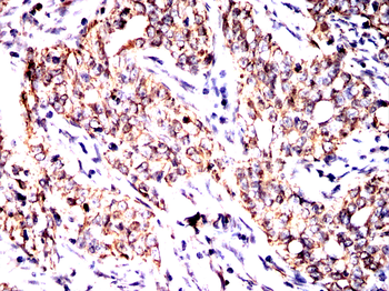 SMAD7 Antibody