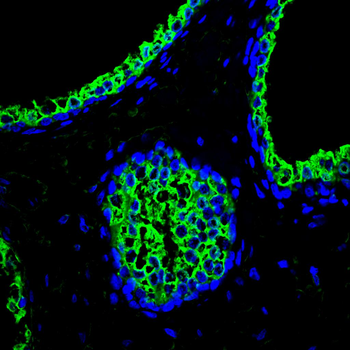 SMAD7 Antibody