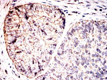 SMAD7 Antibody