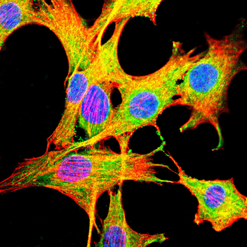 PRKAG1 Antibody