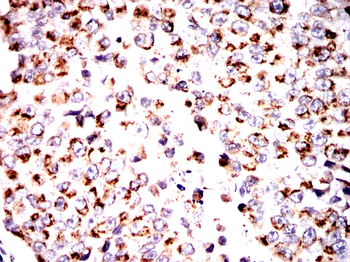 PRKAG1 Antibody