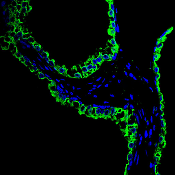 PRKAG1 Antibody