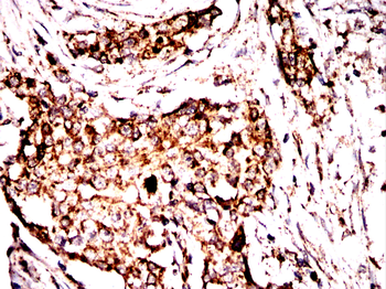 PRKAG1 Antibody