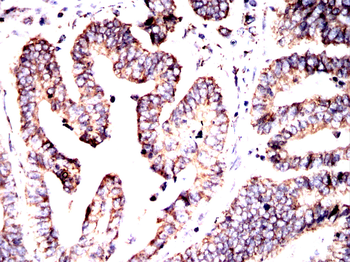 PRKAG1 Antibody