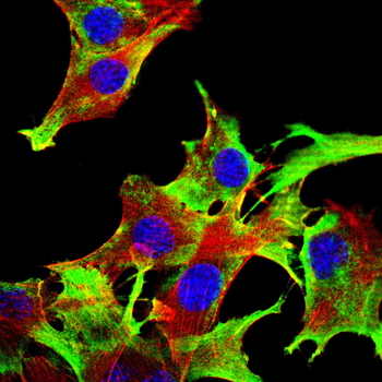 AQP4 Antibody