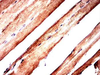 AQP4 Antibody